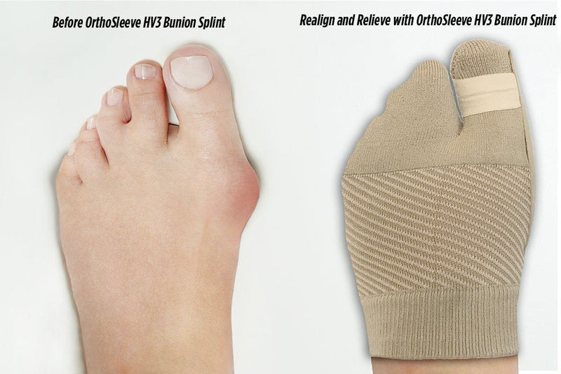 OrthoSleeve HV3 Bunion Brace/Splint (One Sleeve) for Foot Bunion Pain/Hallux Valgus Relief and Split-Toe Design to Help straighten Toes L/XL - BeesActive Australia