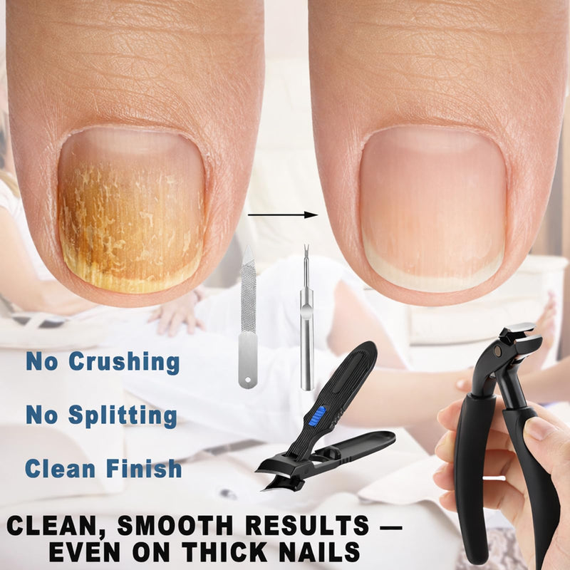 Heavy Duty Nail Clipper Set - Sharp Toenail & Fingernail Clippers for Thick Nails & Seniors, 5-Piece Men’s Grooming Kit with Large Long Handle Toenail Cutter & Slant Edge Trimmer, Gift for Men & Women