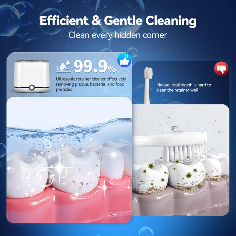 Miorcols Ultrasonic Retainer Cleaner, 48kHz Retainer Cleaner Machine for Dentures, Mouthguard, Braces, Night Guard, Toothbrush, Jewelry with 7.8OZ Dental Cleaning Pod-Cool White Cool White - BeesActive Australia