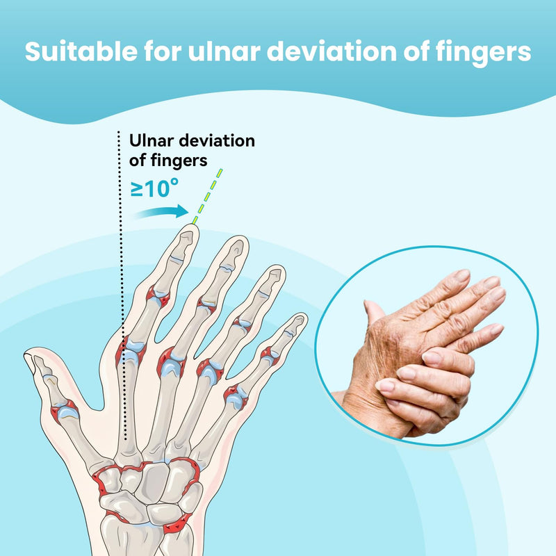 DrFinger Finger Ulnar Deviation Splint Brace, Finger Joint Deviation Orthopedic Corrector With Metal Bracket-Black-(Left-M) Black Left-M
