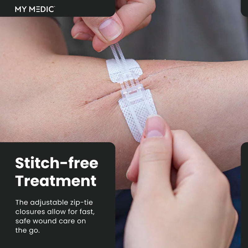 My Medic ZZips MedPack - First Aid Wound Closure Kit for Cuts & Lacerations, Safe Skin Closure Without Stitches, Emergency First Aid Alternative for Sutures