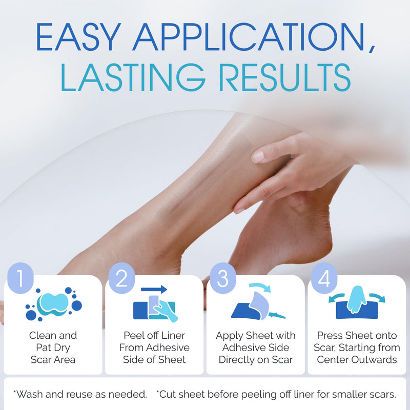 Medical Grade Silicone Scar Sheets - 7" Reusable Water-Resistant Silicone Tape for Scars - Clear Breathable Tape for C-Section, Tummy Tuck, Surgical Scars, and Keloids - 4-Pack 7" – 4 Pack – 30 Day - BeesActive Australia