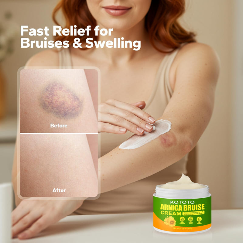 Kototo Arnica Gel for Bruising (4.2 Oz), Fast Relief for Bruises, Swelling & Discomfort, Natural Arnica Bruise Cream with Vitamin K & Herbal Extracts, Soothing Gel for Muscle & Joint - BeesActive Australia