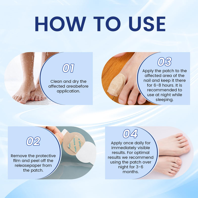 Toenail Fungus Treatment Extra Strength - 21 Pcs Fungal Nail Patches, 8-Hour Firm Adhesion, Nail Repair for Damaged Nails, Overnight Renewal for Men & Women (1 Count (Pack of 21)) 1 Count (Pack of 21) - BeesActive Australia