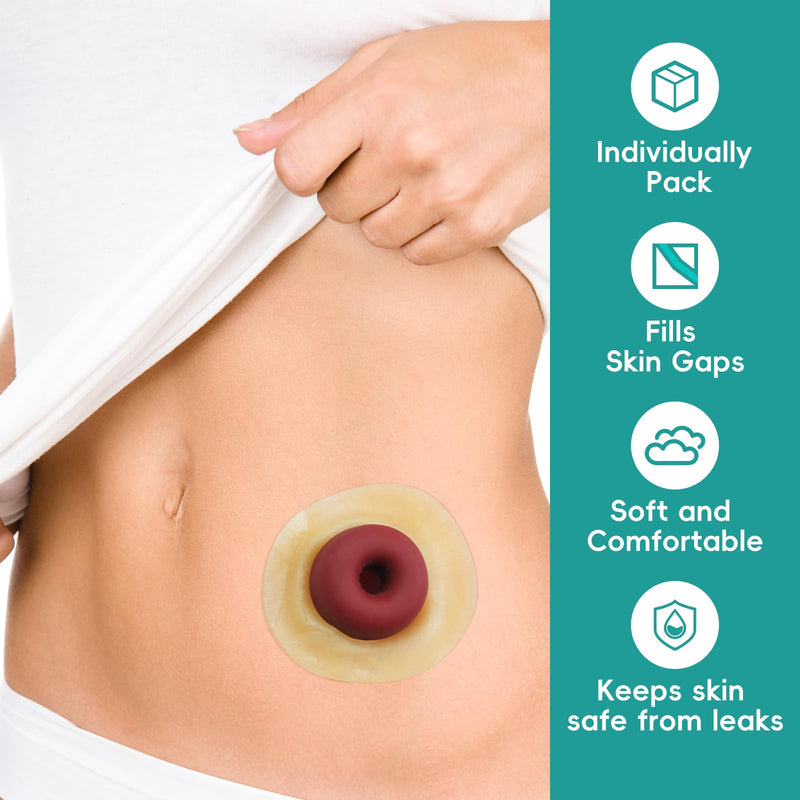 40Pcs Ostomy Barrier Ring - Outer Diameter 2" (50mm) 2mm Thickness,Moldable Ostomy Rings,Hydrocolloid Skin Extender Rings for Colostomy Bags 40 PCS - BeesActive Australia