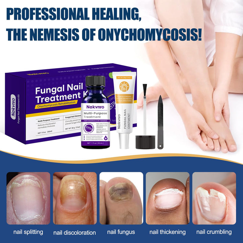 Toenail Fungus Treatment Extra Strength,Nail Fungus Treatment for Toenail,Fungus Nail Treatment Liquid 30ML and Fungal Nail Repair Cream.