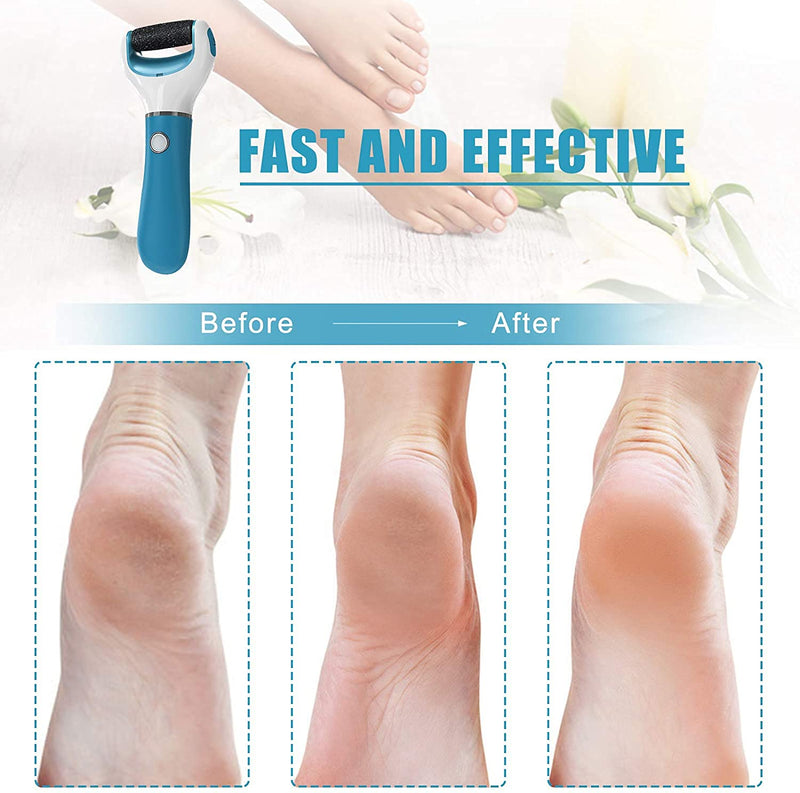 Electric Foot File Callus Remover Professional, 2-Speed Rechargeable Pedicure Tool for Remove Calluses, Dry, Hard, Dead, Cracked Skin, Includes 2 Coarses (Blue) - BeesActive Australia