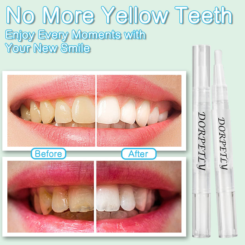 4 Pcs Teeth Whitening Pen for Teeth Brighter, No Sensitivity Teeth Whitening Kit for Oral Care, Travel-Friendly Teeth Whitener Gel for Remove Stains with Effective and Painless - BeesActive Australia