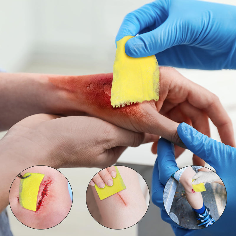 Medical Xeroform Petrolatum Dressing Patch 5"x 9", Non-Adherent Gauze Dressings Soft Fine Mesh Gauze Patch for Burns, Wound Care Lacerations, Skin Grafts Surgical Incision (5x9 in) 5x9 in