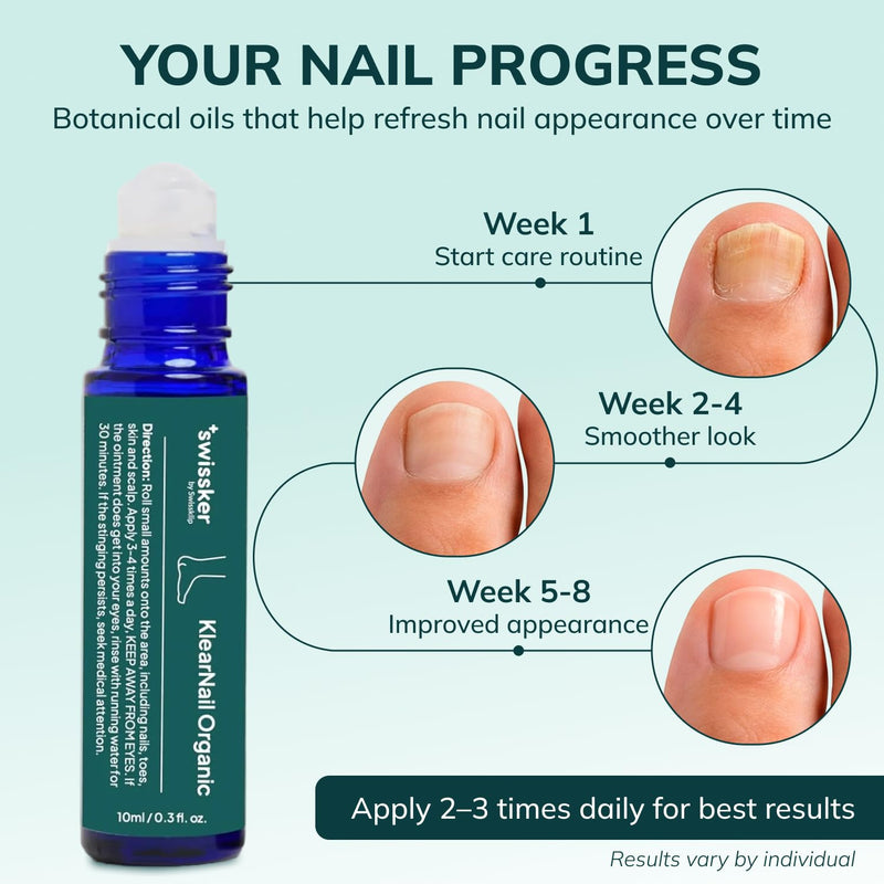 Swissklip KlearNail Toenail Stick | Medi-Care Treatment | Natural Solution for Healthy Nails I Suitable For Foot, Toe, and Fingernail I For Brittle Toenails – 10ml / 0.3 Fl. Oz. Pack 1 - Made in USA 0.3 Fl Oz (Pack of 1)