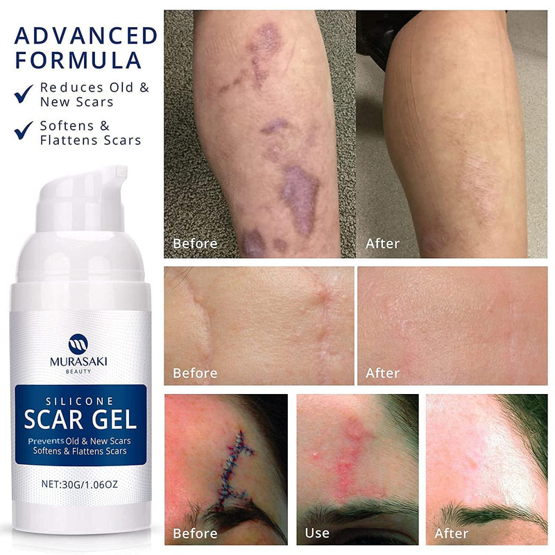 100% Silicone Scar Gel Scar Cream - Advanced Scar Gel for Surgical Scars, C-Section, Stretch Marks, Acne, Injury, Burns, Keloids, Old and New Scars 1.06oz(30g) (Maximum Strength 100% Silicone) Maximum Strength 100% Silicone