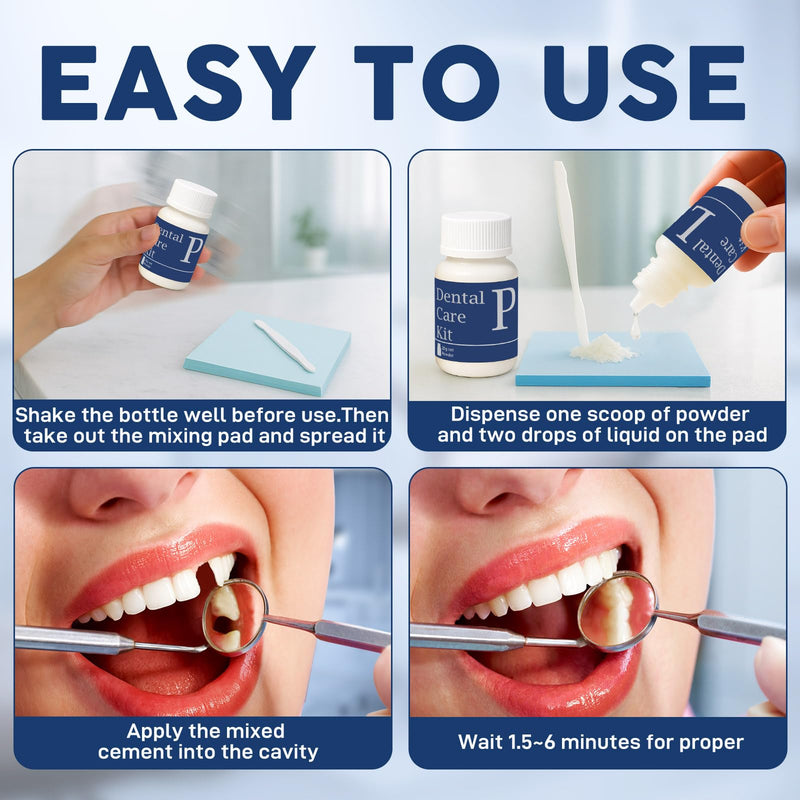 Zinc Oxide Eugenol Dental Cement Tooth Repair kit for Broken Teeth, Temporary Filling for Crowns, Tooth Filler, Cavity Filler for Teeth - BeesActive Australia