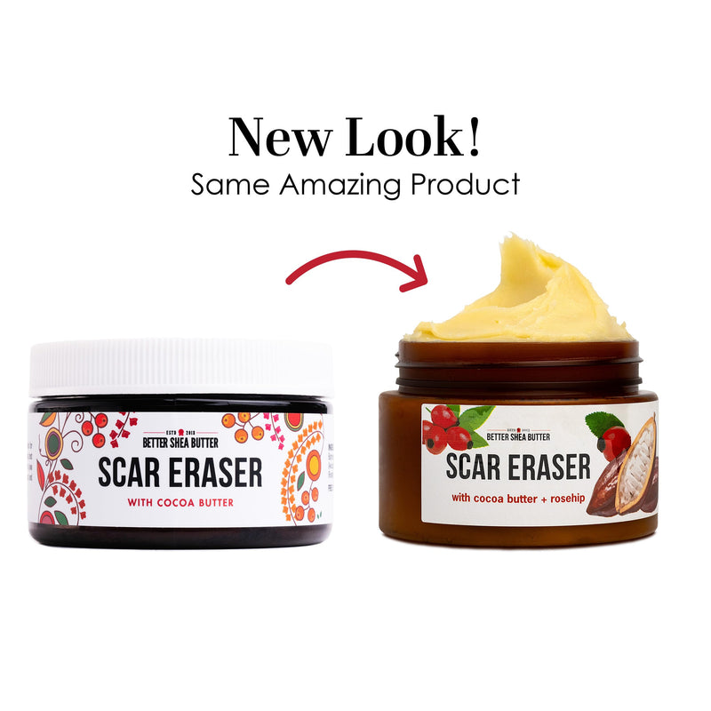 Better Shea Butter Scar Eraser Balm - Cocoa Butter Cream for Stretch Marks and Dark Spots, Burns, Old Scars - Acne Scars - Designed w Zero Synthetic Ingredients, 4 oz - BeesActive Australia