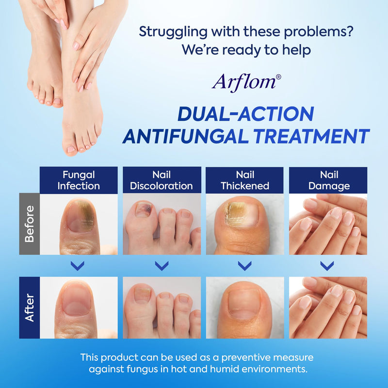 Toenail Fungus Treatment Kit: 2 Pcs Extra Strength 25% Undecylenic Acid Solution & 14 Fungal Nail Renewal Patches - for Toe Nail & Fingernail with Tea Tree Oil