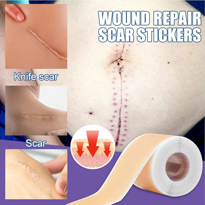 Silicone Scar Sheet, Reusable Silicone Scar Strip Roll Scar Sheet Breathable Scar Removal Sheet Scar Strip Silicone Scar Tape Roll Scar Silicone Tape Cover Up Silicone Gel Cream Patch Bandage - BeesActive Australia