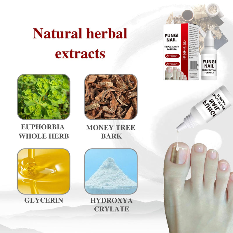 Toenail Fungus Treatment, Herbal Extracts, Nighttime Long-Lasting Nail Treatment, Suitable for Discoloration, Shaped Nails, Thick Nails, Safe and Gentle, Cuticle Care, 15ml/0.5oz (one) 0.5 Fl Oz (Pack of 1)