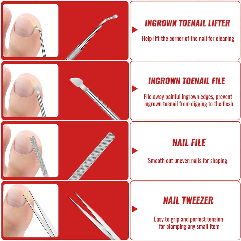 Ingrown Toenail Removal Kit, Ingrown Toenail Tool Kit with Ingrown Toenail Corrector, Ingrown Toenail Drops, Corrector Patch, Toenail Clipper, Nail File Lifter Tools - BeesActive Australia
