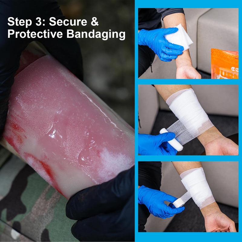 RHINO RESCUE Burn Kit, 4pcs Burn Dressings 4x4”, 8pcs Burn Gel Packets 3.5g, 4pcs Burn Pads, First Aid Kit Cooling Soothing Cream Relief with Bandage, Nitrile Gloves, Scissors, Tape - BeesActive Australia