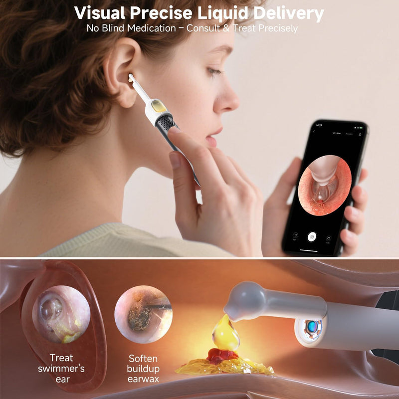 BEBIRD R1 Ultra Ear Wax Removal, Ear Cleaner with Camera Ear Scope, Wax Remove Ear Pick with Ear Otoscope Tweezers, Visual Dropper Cleaning Kit, Ear/Nose/Throat Examination Tool for Family Black - BeesActive Australia