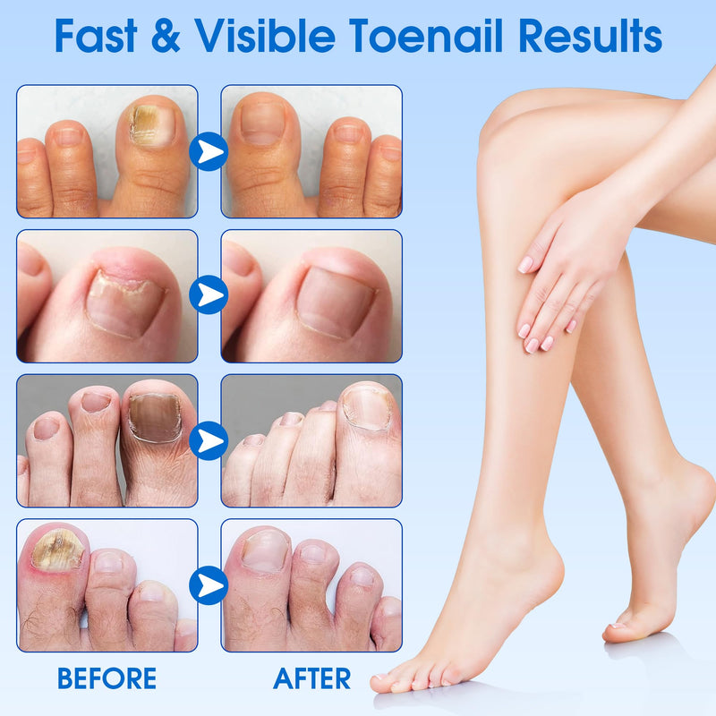 EASICUTI Fungal Nail Patches, 60 PCS Toenail Treatment Extra Strength, Overnight Nail Repair Sticks for Damaged Nails, Men and Women