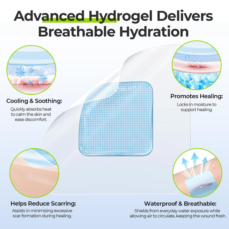 AUVON Hydrogel Burn Dressings 4" x 4" for Instant Cooling Relief & Moist Healing, Adhesive Burn Pads for 1st-2nd Degree Burns, Cuts, Abrasions, Waterproof Wound Dressing for Home First Aid Kit, 10 Pcs 4x4 Inch (10 Pcs)
