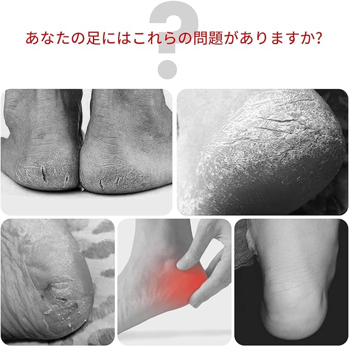 RICISUNG 2 Pair Set Heel Care Socks for Cracking and Exfoliating Skin Moisturizing Foot Heel Exfoliating Ankle Moisturizing Gel Smooth Moisturizing Dry Hard Cracked Skin Unisex - BeesActive Australia