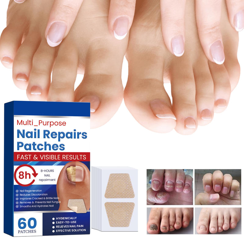 Fungal Nail Patches,60 pcs Toe Nail Fungus Treatments Patches,Nail Fungus Treatment Extra Strength,8-Hour Overnight Nail Treatment Restores Healthy Appearance