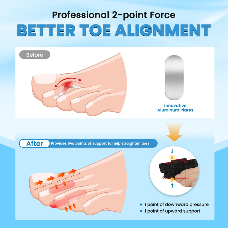 Hammer Toe Straightener - Non-Slip Hammer Toe Corrector for Women & Men - Adjustable Toe Splint Relief for Curled, Broken Support - Toe Wrap for Resting, Standing (1 Foot Wrap & 1 Strap) - BeesActive Australia