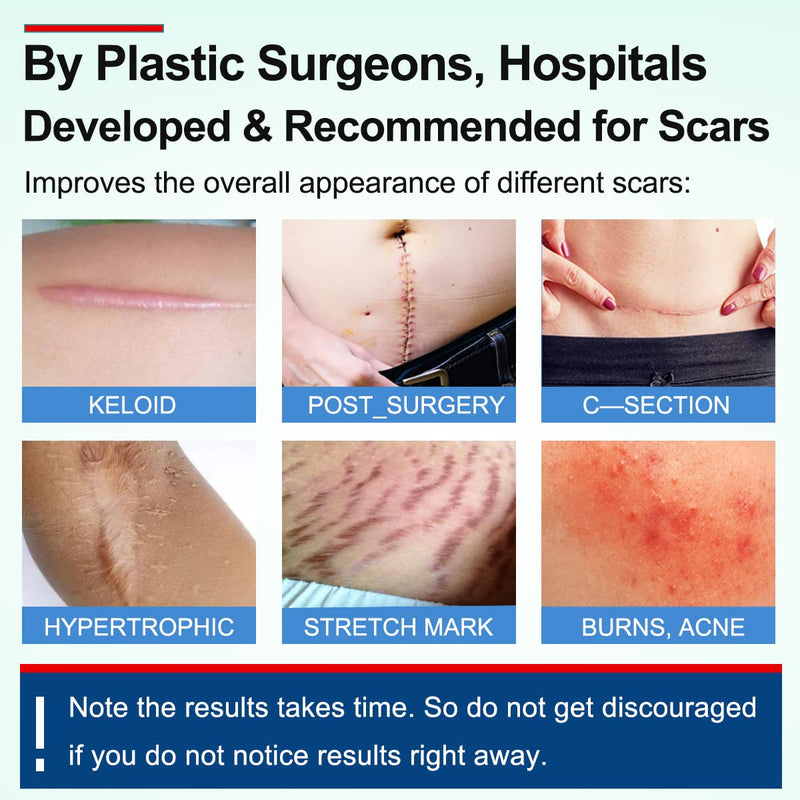 Silicone Scar Sheets Tape for Surgical Scars, C Section Scar Silicone Strips, Medical Grade, Reusable, Soften and Flattens Scars, Breast, Keloid, Professional Scar Patches. (1.8x157 Inch) 1.8x157 Inch
