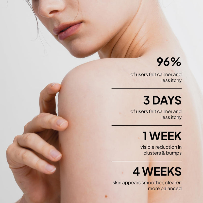 BellamiLuxx Fungal Acne Treatment Lotion: Effective Face & Body Pimple Cream for Bumps, Clusters, Itch & Redness – Fungal Prone Skin Acne Treatment Moisturizer for Teens & Adults with Natural Actives 1-Bottle - BeesActive Australia