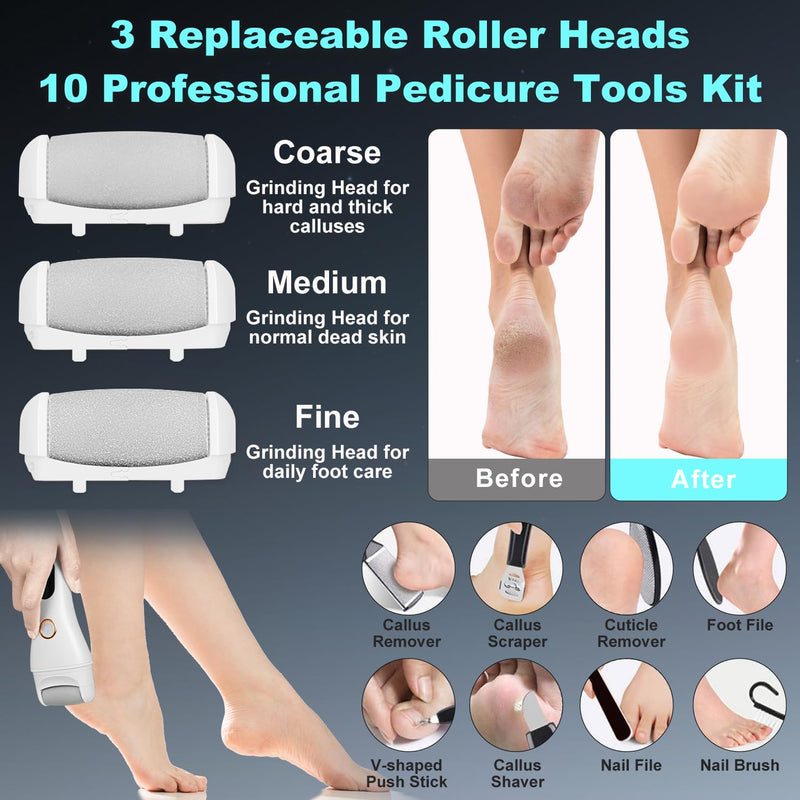 Callus Remover for Feet, 3 Speed Electric Foot Scrubber with Larger Grinder&LCD Display, Wet&Dry Using Foot File Professional Pedicure Tools, Foot SPA to Remove Callus Cracked&Hard Dead Skin (White) White - BeesActive Australia