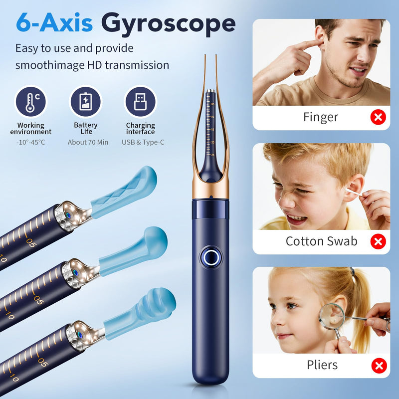 Ear Wax Removal, Ear Cleaner with Camera 1296P HD,Visual Ear Cleaner with 6 LED Lights and Flexible Tip,FSA HSA Eligible Items,Safe Ear Wax Removal Kit with Camera,Ear Cleaning Tool for Family Gifts Black - BeesActive Australia