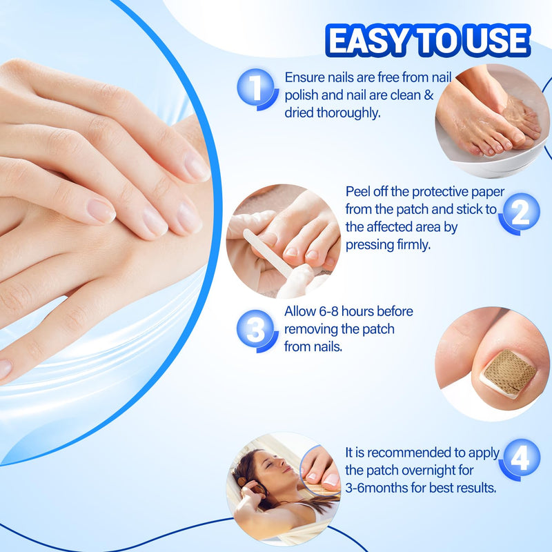 Toenail Fungus Treatment - 50Pcs Fungal Nail Patches Extra Strength with Hydrogel for Overnight Repair Nail Fungus Patches, Not Easy to Fall Off Toenail Corrector Patch 50 Count (Pack of 1)