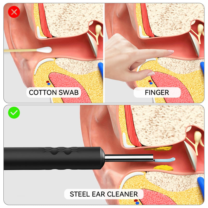 1080P HD Ear Camera with 6 LED Lights - Waterproof Rechargeable Otoscope Tool, Ear Wax Removal Kit with 8Pcs Ear Care Set for iOS & Android Ear Cleaner A - BeesActive Australia