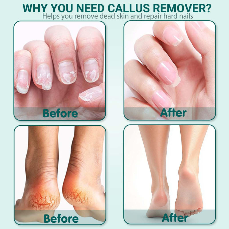 Electric Foot Callus Remover for Feet,15 Speed Adjustable Pedicure Tools for Feet with LED Display, 2 in 1 Nail Drill Foot File, Rechargeable Electric Foot Scrubber for Dead Skin and Thick Toenail