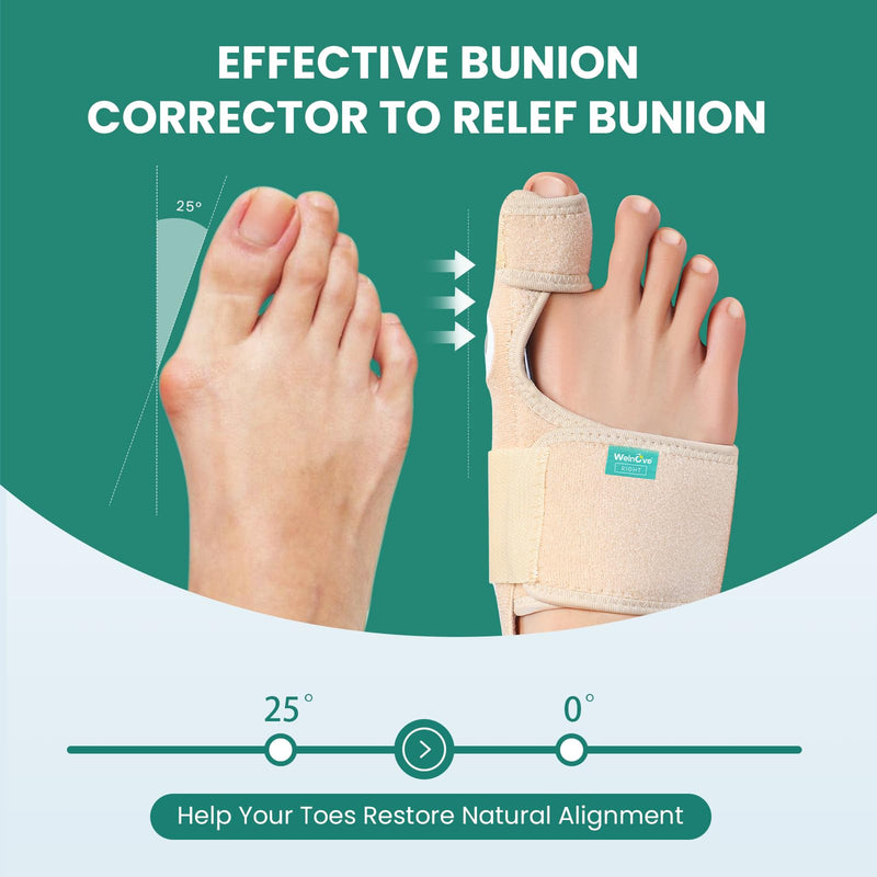 Welnove Bunion Corrector Women & Men Big Toe: 1 Pair Bunion Splint - Adjustable Bunion Correction - Toe Straightener with Non-slip Strap, Day Night Support (Beige) - With 2 Gel Separators