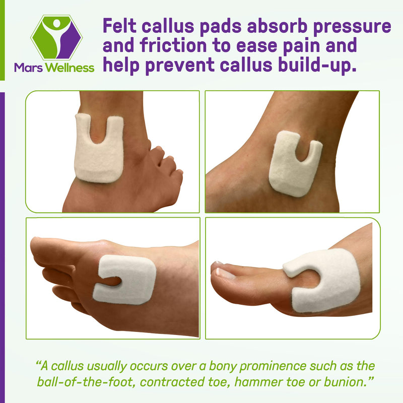 U Shaped Skived Felt Callus Horseshoe Pads - Adhesive Foot Pads That Protect Calluses from Rubbing On Shoes - Skived 1/4" - 25 Pack - BeesActive Australia