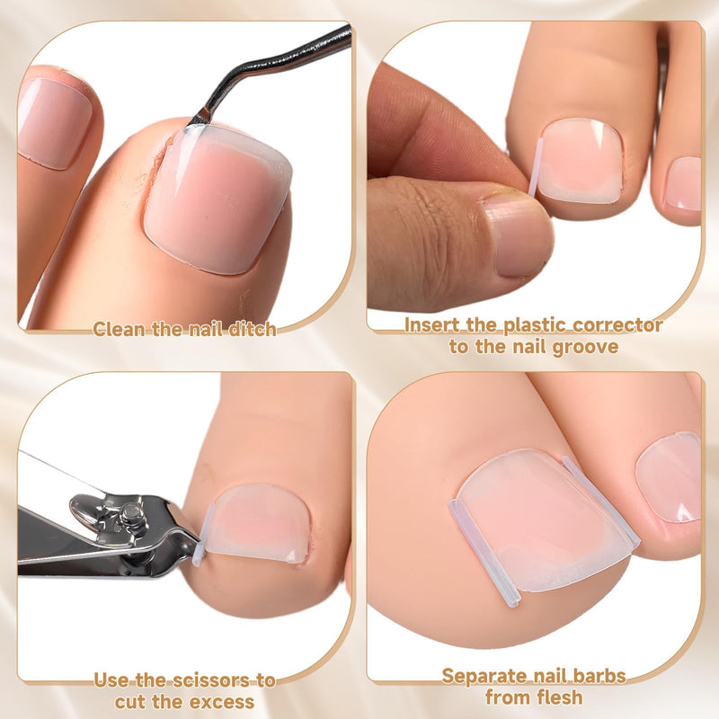 201 Pcs Ingrown Toenail Corrector Kit with Breathable Correction Strips, Curved Nail Patches, Toenail Lifter Tools, Complete Home Pedicure Set for Daily Nail Grooming & Nail Shaping