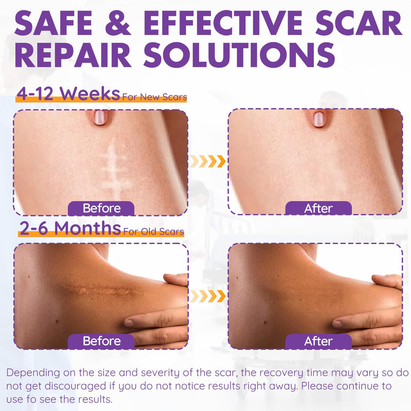 Silicone Scar Sheets, Silicone Scar Tape(1.6"x 79" Roll-2M), Reusable Professional Scar Silicone Strips, Soft Silicone Scar Sheets for Surgical Scars,Keloid,Acne Scars,Burn Scar,C-Section