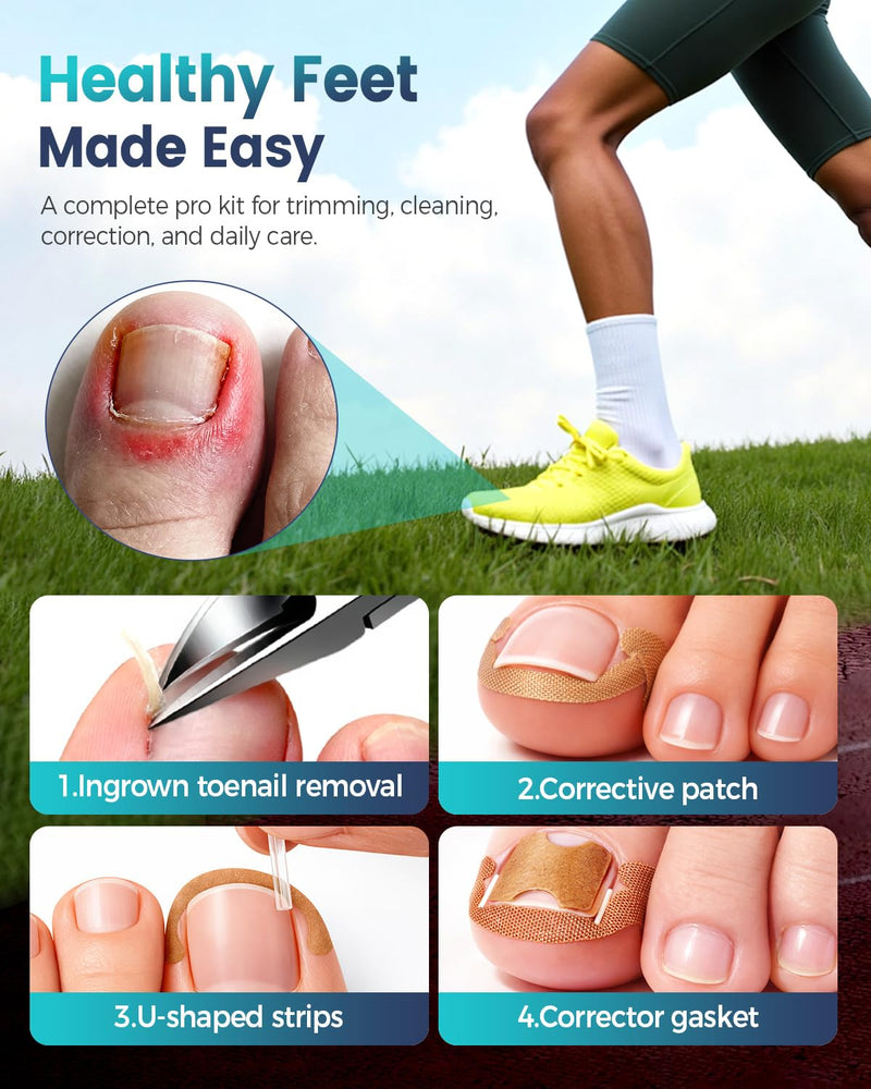 Professional Ingrown Toenail Corrector, 2-in-1 Ingrown Toenail Removal Kit with U-Shaped Strips and Correction Patch, Ingrown Toenail Clippers Tool Set- Effective Removal of Ingrown Toenails (Silver) Silver - BeesActive Australia