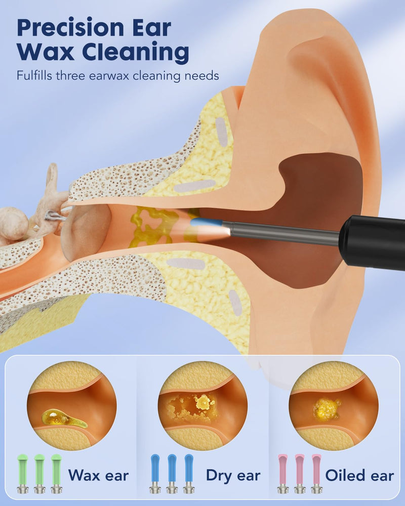 Ear Wax Removal,Littlelucky- 4 in 1 Ear Canal Cleaner 1080P HD Lens with 6 LED Lights for Ear/Nose/Throat/Skin Viewing,Ear Cleaning Kit with 6 Piece Ear Set & 9 Replacement Tips for iOS & Android - BeesActive Australia