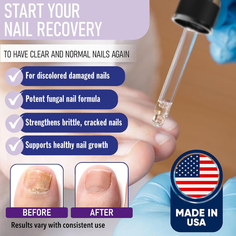 ZanaQuick Extra Strength Toenail & Fingernail Repair Drops - Nail Care Renewal for Thick, Damaged & Discolored Nails - 2 Pack 0.5 Fl Oz (Pack of 2) - BeesActive Australia