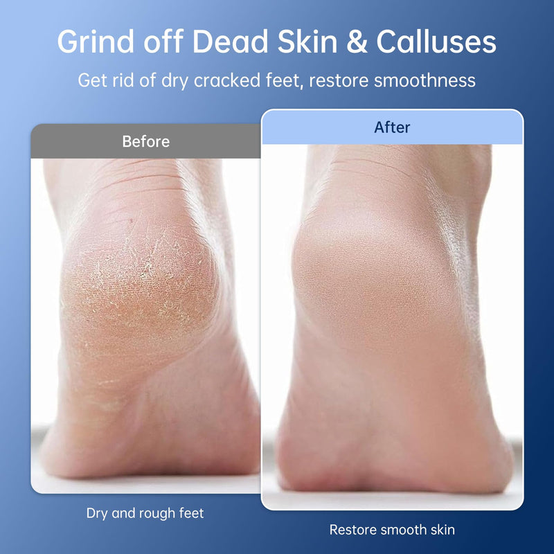 Electric Callus Remover for Feet - Rechargeable Foot Sander, 6 Speeds, Replaceable Sandpaper Professional Foot Grinder, Cordless Electric Foot File Pedicure Tools for Dead Skin, Cracked Heels - BeesActive Australia