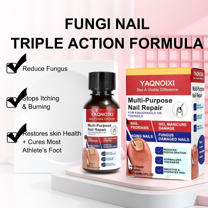 Toenail Fungus Treatment - Fast Acting For Thick, Discolored, Broken & Damaged Toe & Finger Nail, Treats Damaged Nails and Ingrown Toenails - 30ml/1oz (1pcs) 1pcs