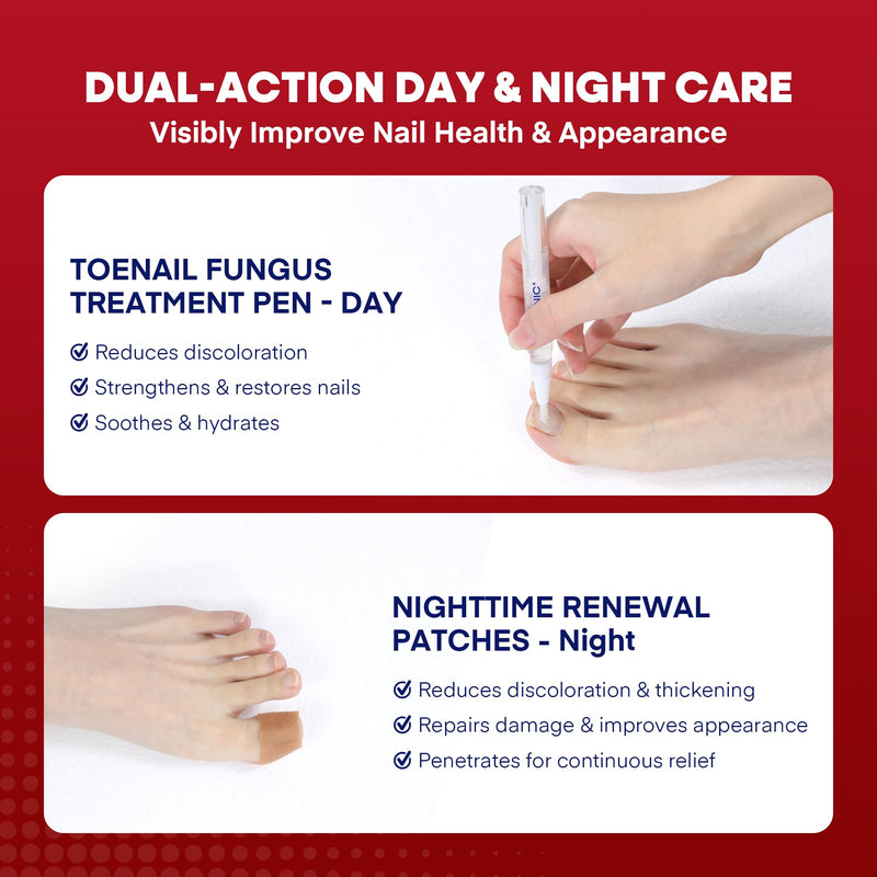 Treatonic Toenail Fungus Treatment Kit: Antifungal Nail Fungus Treatment Extra Strength with 25% Undecylenic Acid (3 Pens) & 32 Night Fungal Nail Patches - Repairs Damaged & Restores Discolored Nails 1-Pack(3 Pens + 32 Patches)