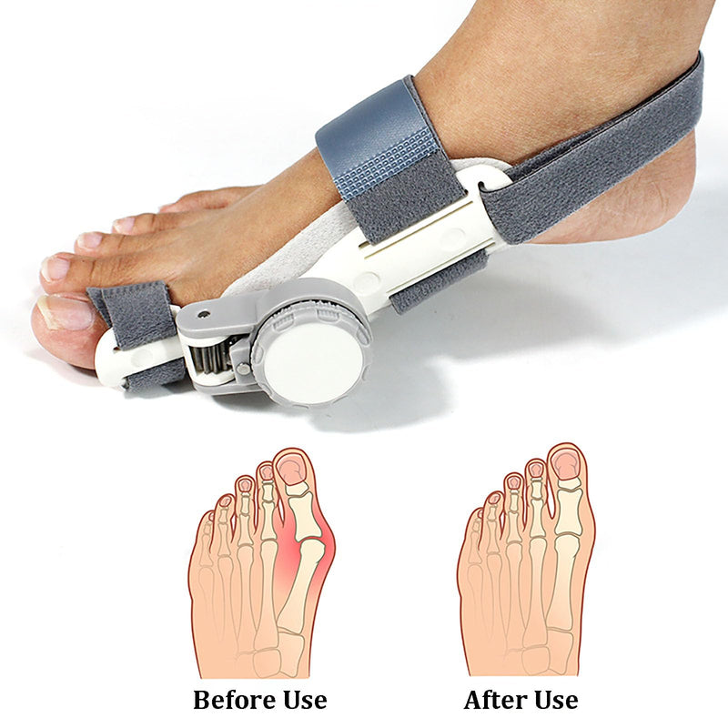 Bunion Corrector for Women & Men, Comfortable Big Toe Straightener with Silicone Pad | Adjustable Knob - Snug Fit for Left/Right Big Toes, Wear While Sleeping (1 Pack)