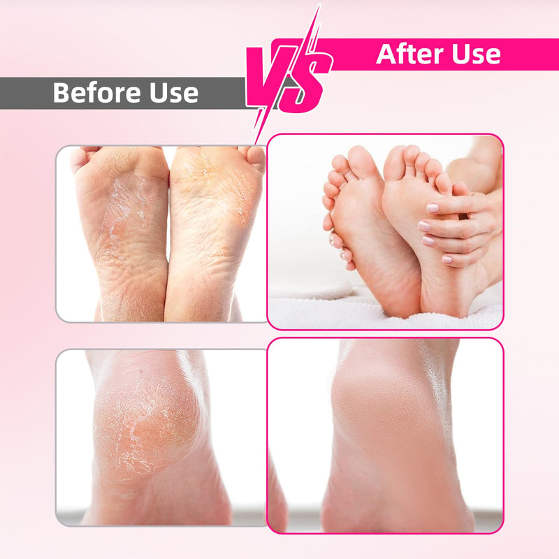 Electric Foot File Callus Remover - 3 Speeds & 4 Nano Glass Heads for Smooth Feet - Professional Pedicure Tool for Dead Skin Hard & Cracked Heels - Rechargeable & Portable - BeesActive Australia