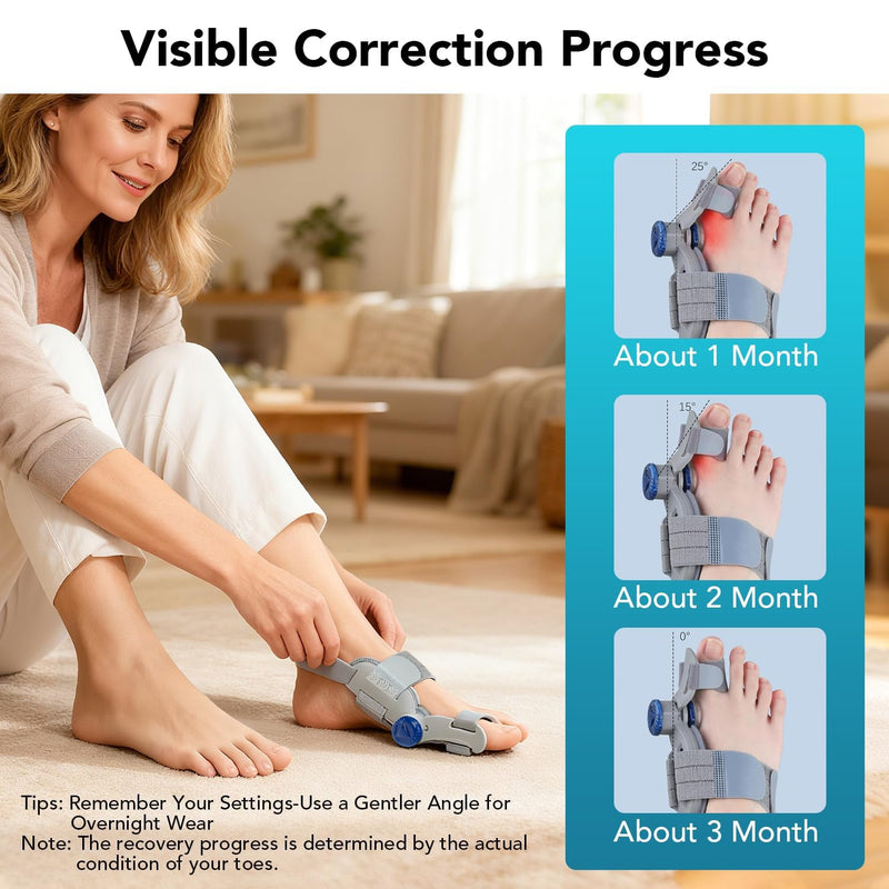 Bunion Corrector for Women & Men Big Toe, Upgraded Big Toe Straightener Bunion Fix with Adjustable Knob, Separator Reliefer with Soft Gel Pad for Left/Right Feet (Gray 1Pcs) Gray1 - BeesActive Australia