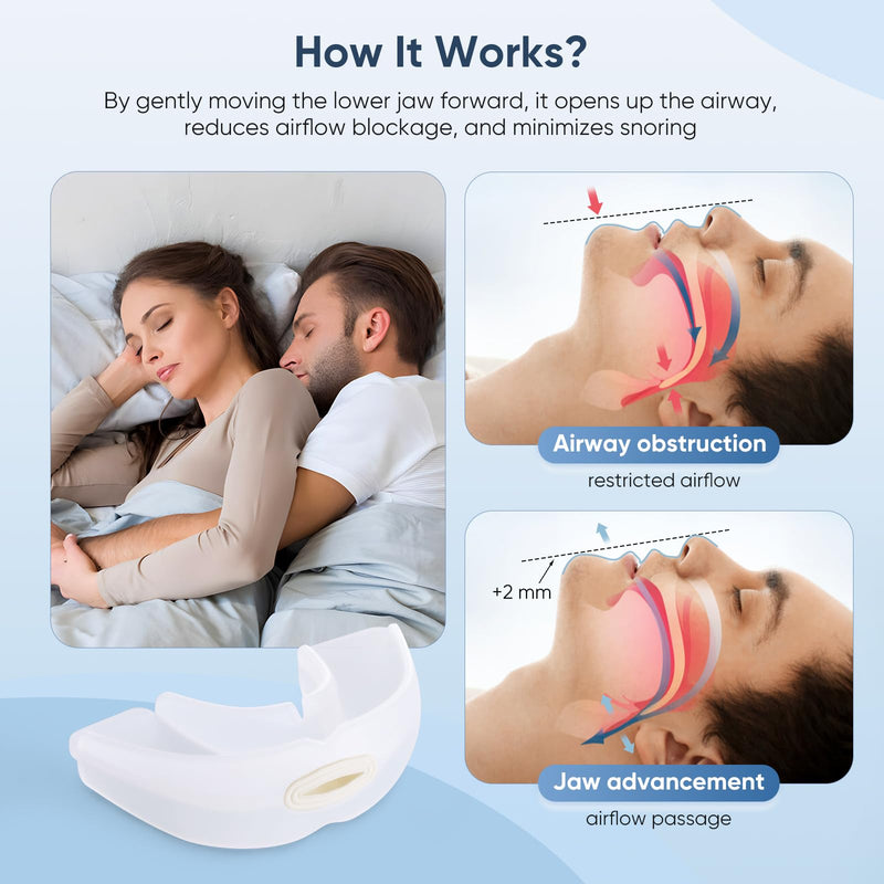 Anti-Snoring Device, Reusable Snore Stopper Anti Snoring Mouthpiece, Snoring Solution Mouthpiece Stop Snoring for Men and Women Green - BeesActive Australia