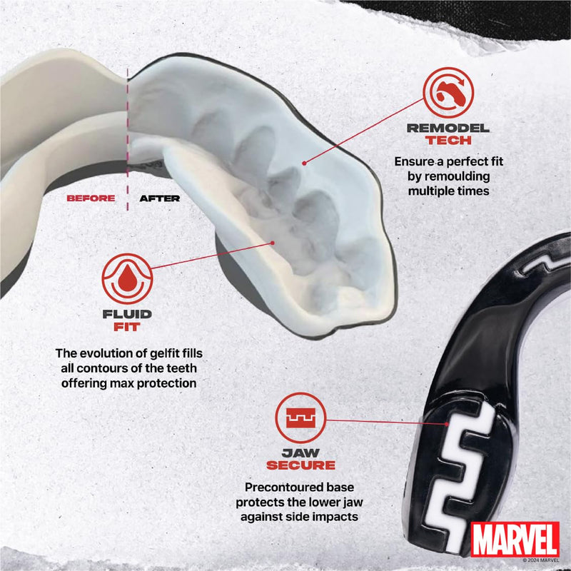 Marvel Venom Mouth Guard, Dual Layer Mouthguard for Youth with Case, Easy Fit Remoldable Mouthpiece for Football, Boxing, Lacrosse, MMA, Basketball & All Contact Sports (Kids <11 Years, Black) Junior (up to 11 Year)